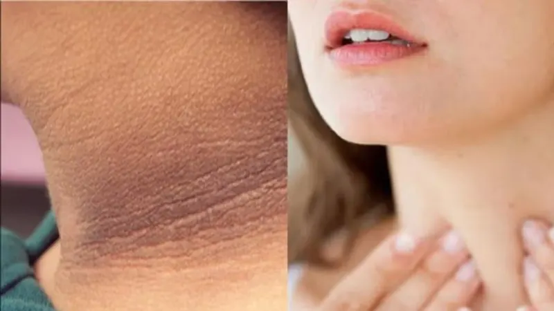 রোদে গেলেই ত্বক কালো হয়ে যায়? জানুন ৫টি প্রাকৃতিক উপায়