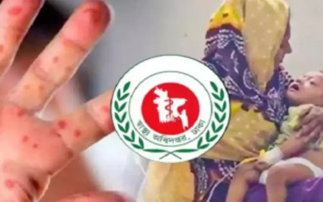 হামে রেকর্ড পরিমাণ প্রাণহানি, মৃ’ত্যু প্রায় সাড়ে ৫০০