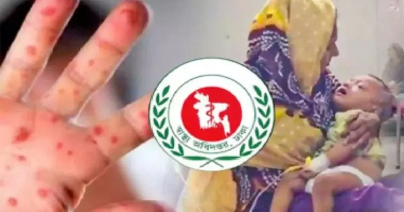 হামে রেকর্ড পরিমাণ প্রাণহানি, মৃ’ত্যু প্রায় সাড়ে ৫০০