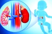 গর্ভে যে কারণে শিশুর কিডনি ফুলে যায়-জন্মের পর করণীয়