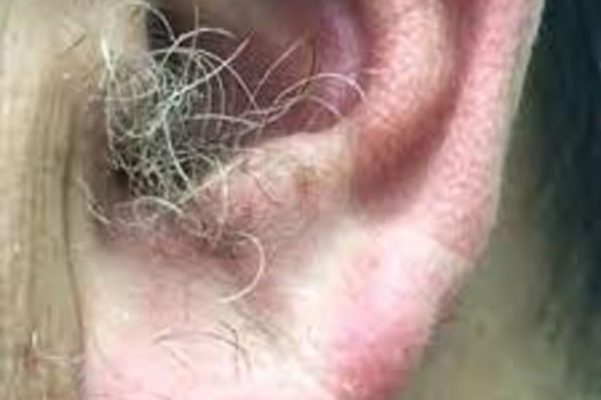 কানে চুল গজানো কিসের লক্ষণ? জানলে অঁতকে যাবেন