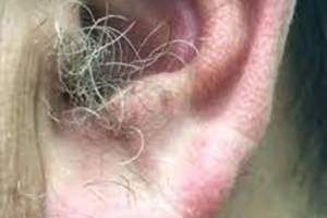 কানে চুল গজানো কিসের লক্ষণ? জানলে অঁতকে যাবেন